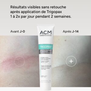 Acm Trigopax Soin Protecteur Apaisant 40ml 9