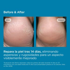 Isdin Ureadin Podos Gel Huile Hydratant Pieds 75ml 11