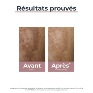 Eucerin Anti Pigment Serum Duo 30ml 3