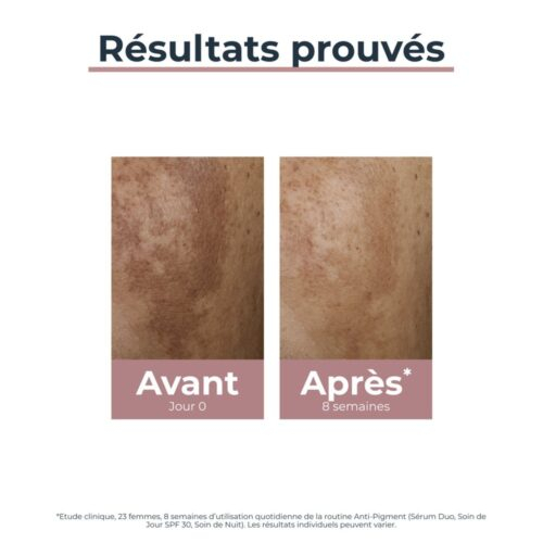 Eucerin Anti Pigment Serum Duo 30ml 3