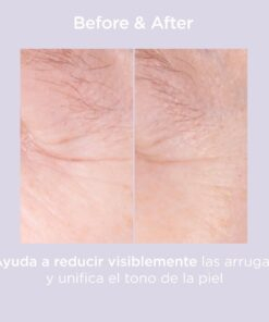 Isdin Isdinceutics Glicoisdin 15 Moderate Gel Exfoliant 50g 9