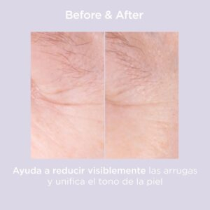 Isdin Isdinceutics Glicoisdin 15 Moderate Gel Exfoliant 50g 9