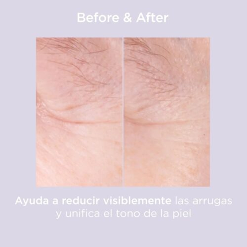 Isdin Isdinceutics Glicoisdin 15 Moderate Gel Exfoliant 50g 9