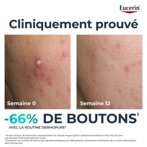 Eucerin Dermopure Serum Clinical Triple Action 40ml 2