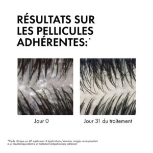 Vichy Dercos Ds Shampoing Traitant Anti Pelliculaire Cheveux Secs Eco Recharge 390ml 6