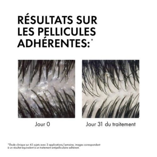 Vichy Dercos Ds Shampoing Traitant Anti Pelliculaire Cheveux Secs Eco Recharge 390ml 6