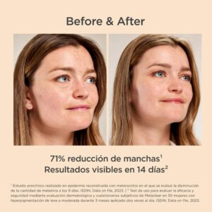 Isdin Isdinceutics Melaclear Serum Anti Taches Brunes 30ml 10